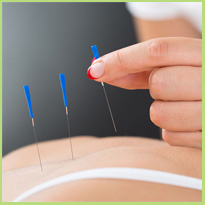 Acupunctuur en zwangerschap. Kan het kwaad?