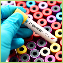 Legionella besmetting: wat is het en hoe voorkom je het?