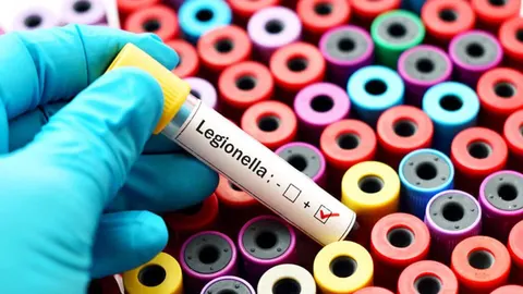 Legionella besmettingen: wat is het en hoe voorkom je het?