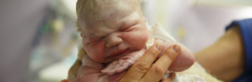 Fotoshoot van de bevalling: doen of niet doen?