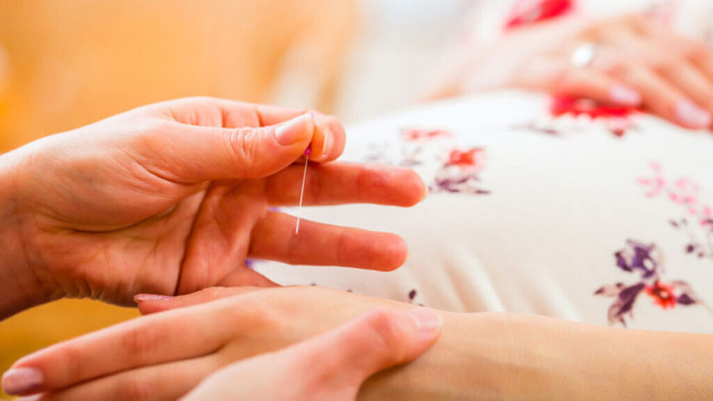 Acupunctuur tijdens de zwangerschap