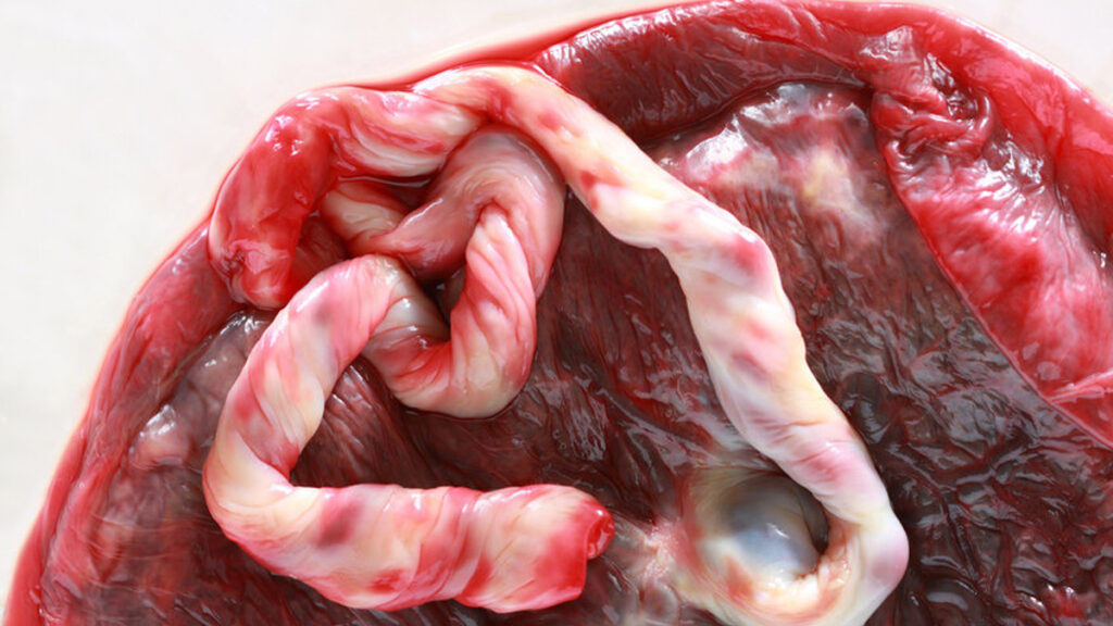 De placenta bewaren na de bevalling. Wat kun je ermee?