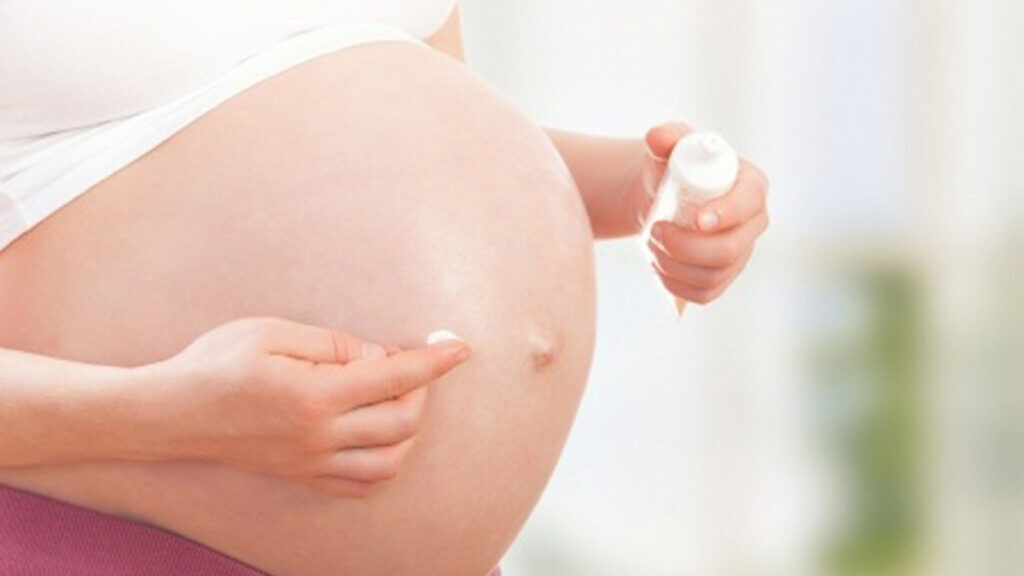 Striae of zwangerschapsstriemen, hoe zijn ze te voorkomen?