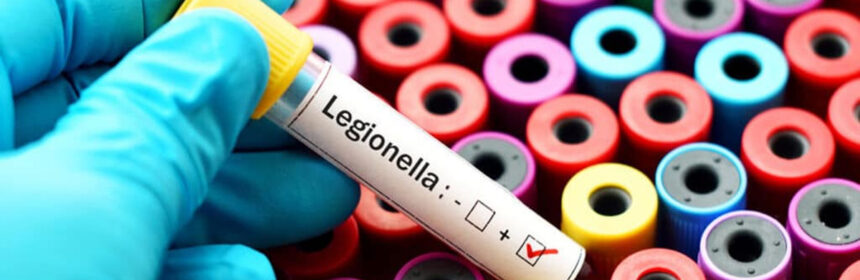 Legionella besmettingen: wat is het en hoe voorkom je het?