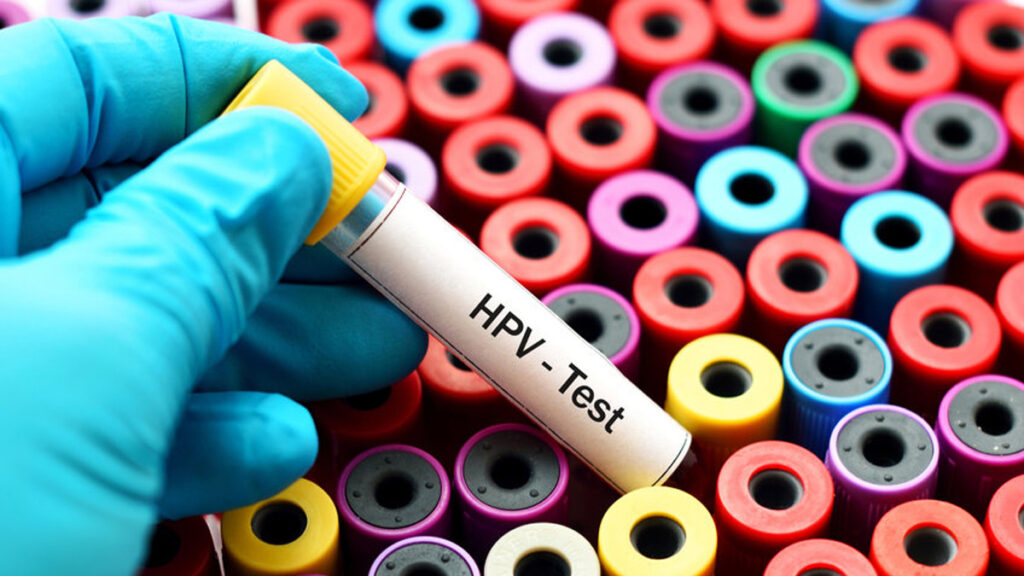 HPV en baarmoederhalskanker. Wat zijn de risico's?