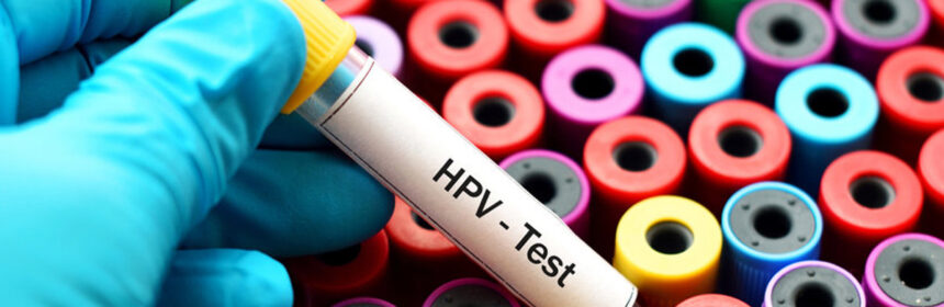 Wat is HPV en hoe kun je het krijgen?